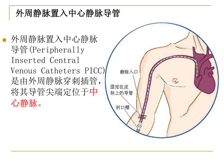 PICC相关静脉的解剖.ppt_第2页