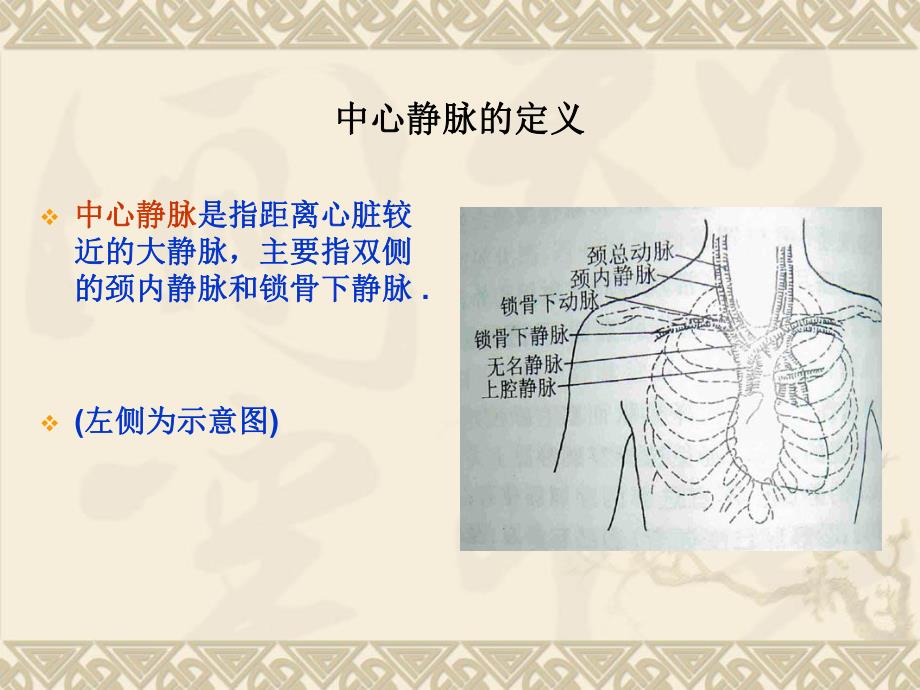 中心静脉置管的护理1.ppt_第3页