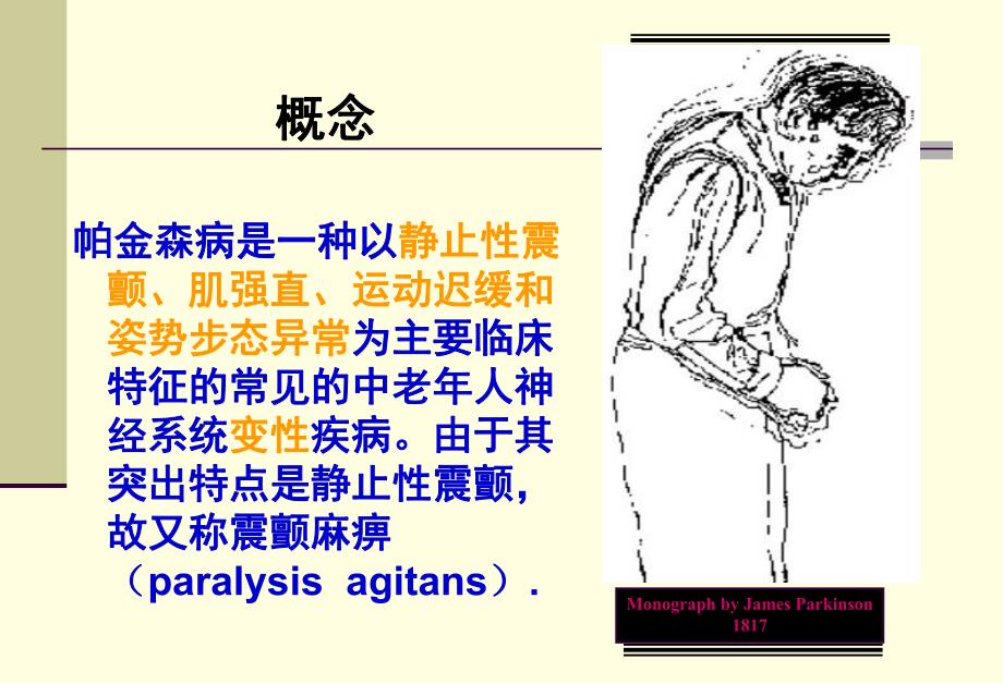 【精品PPT】帕金森病护理指南.ppt_第3页