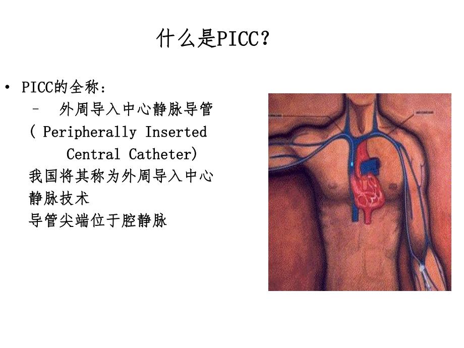 PICC导管穿刺及护理.ppt_第2页