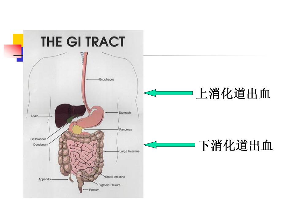 【医药健康】上消化道大出血病人的护理.ppt_第3页