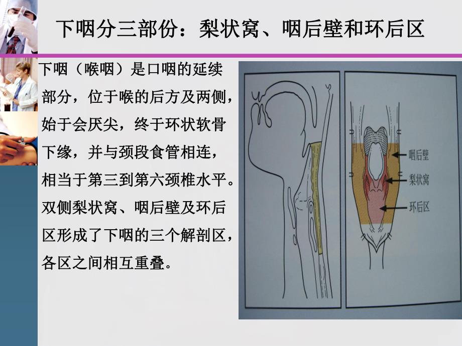 下咽癌护理查房.ppt_第3页