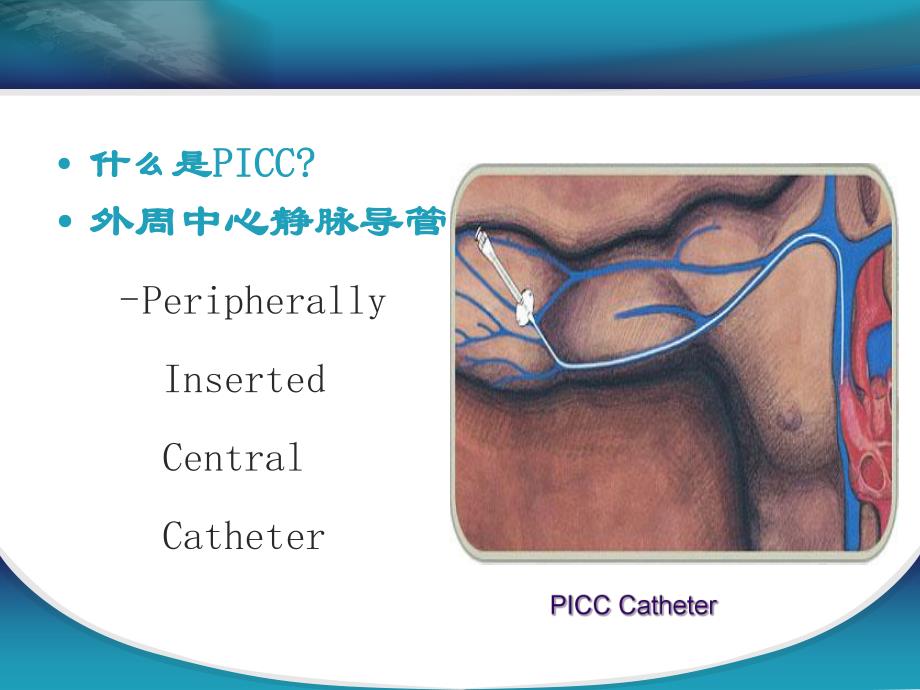 PICC维护过程中常见的并发症.ppt.ppt_第2页