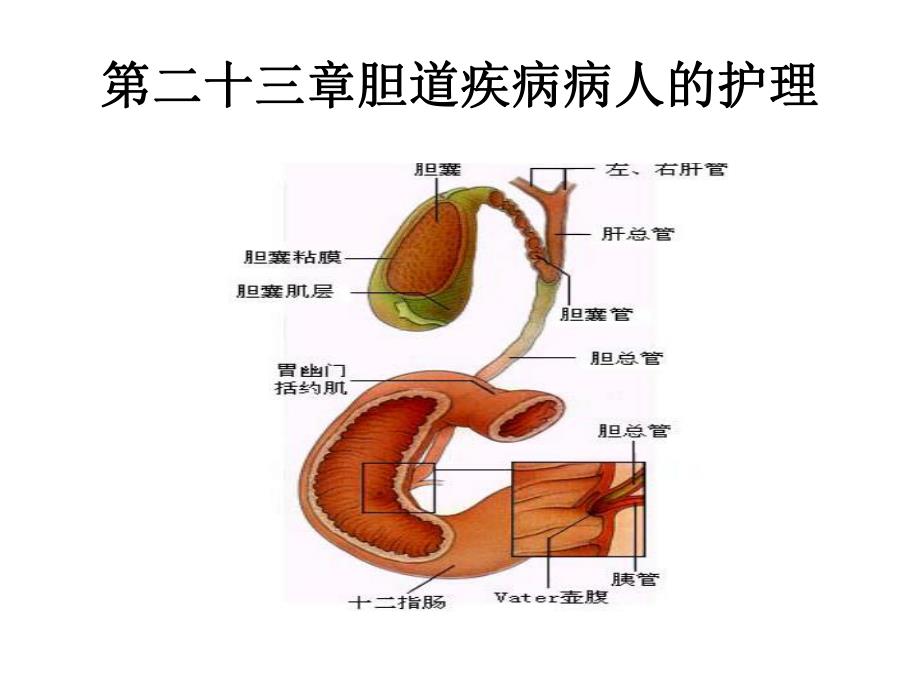 胆道疾病病人的护理.ppt_第1页