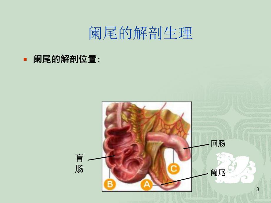 阑尾炎病人的护理.ppt_第3页