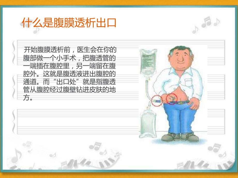 腹膜透析出口护理.ppt_第2页