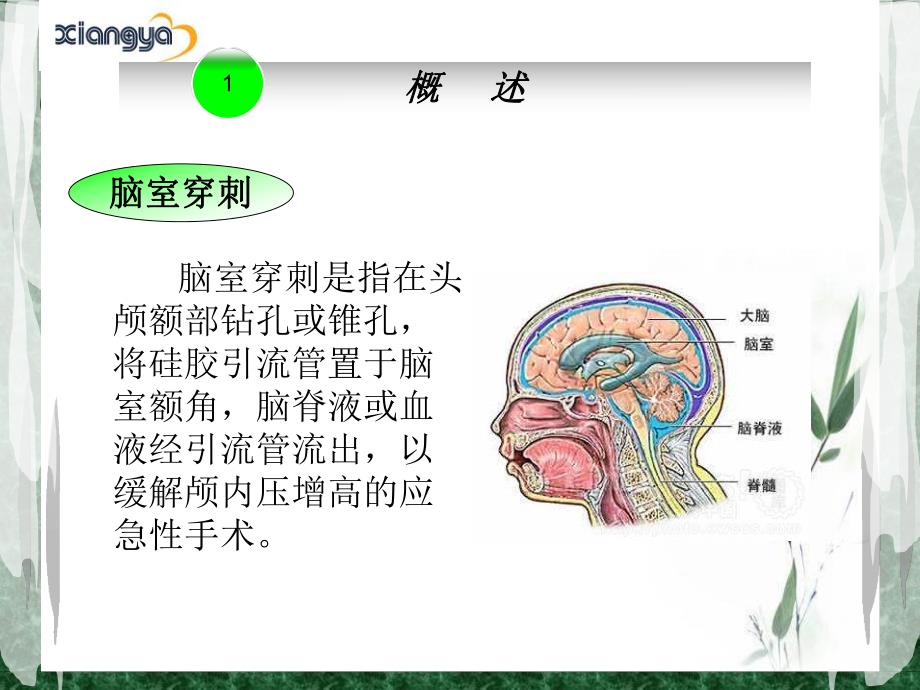 脑室引流管的护理幻灯片..ppt_第3页