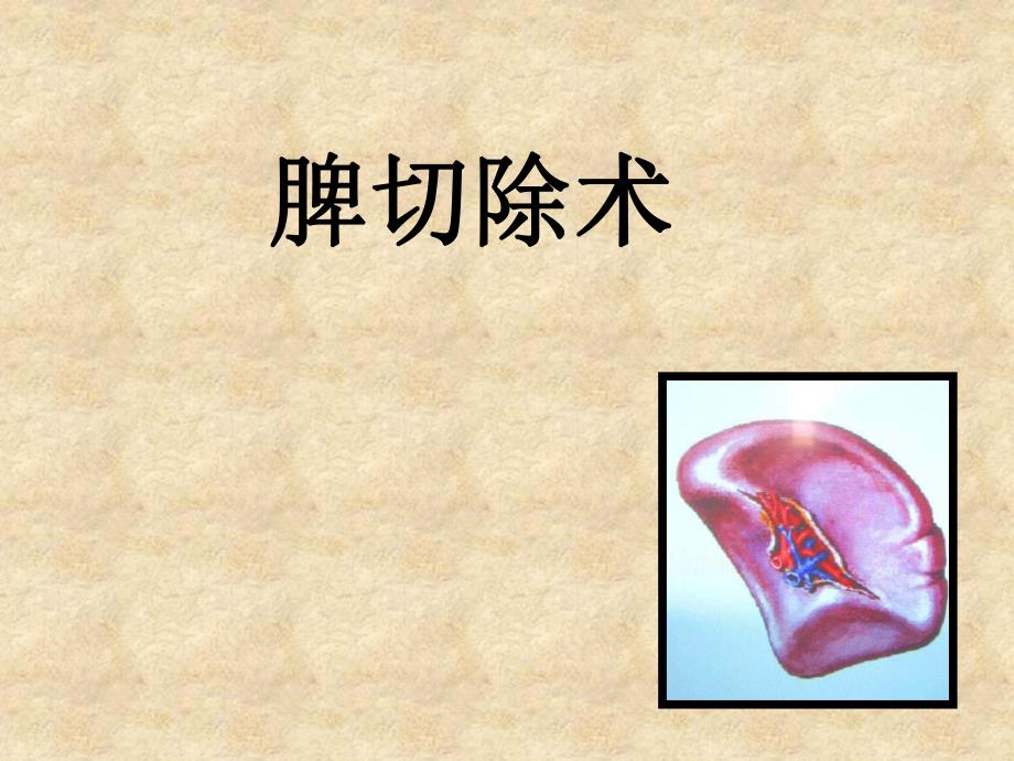 脾切除术的护理.ppt_第1页