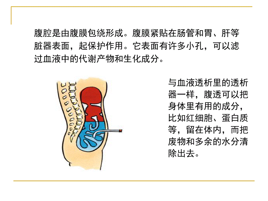 腹膜透析的护理.ppt_第3页