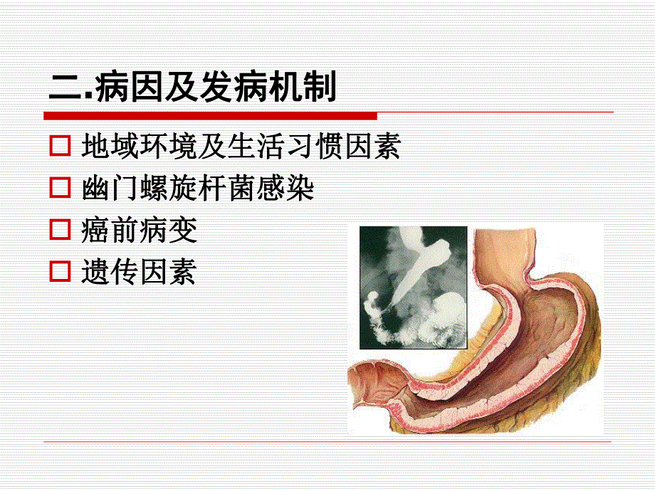 胃癌病人的护理1.ppt.ppt_第3页