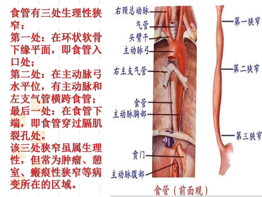 食管癌护理查房.ppt_第3页