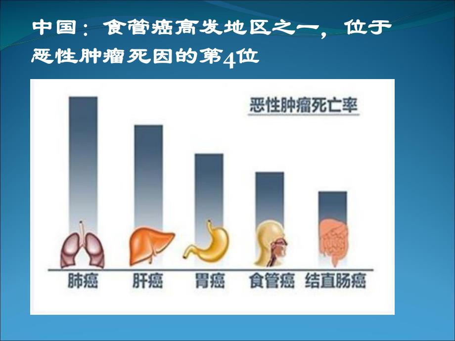 食管癌护理.ppt_第3页