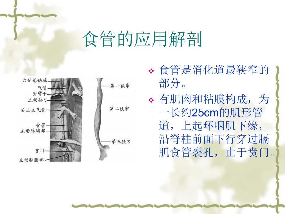 食管异物的护理.ppt_第3页