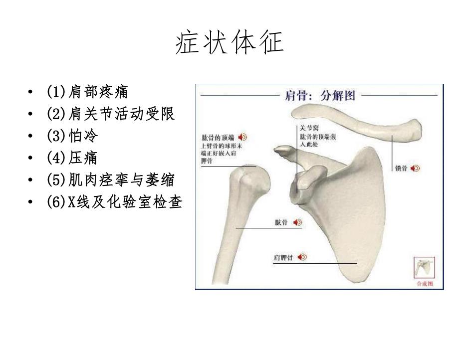 肩周炎的护理.ppt_第3页