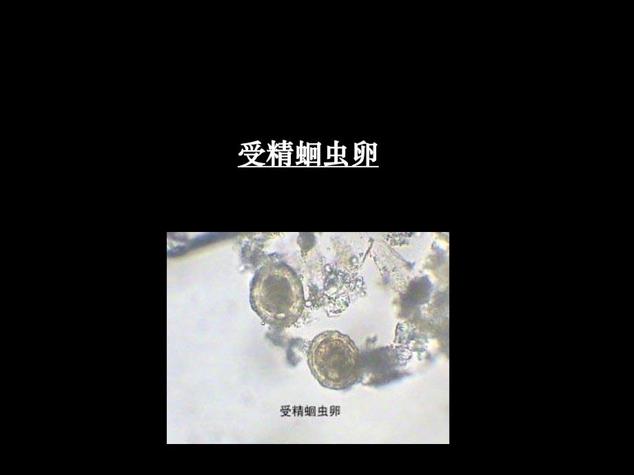 人体寄生虫标本考试.ppt_第1页