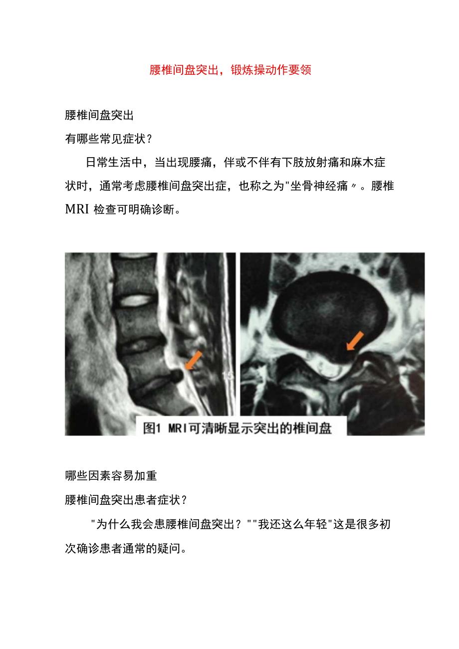 腰椎间盘突出锻炼操动作要领.docx_第1页