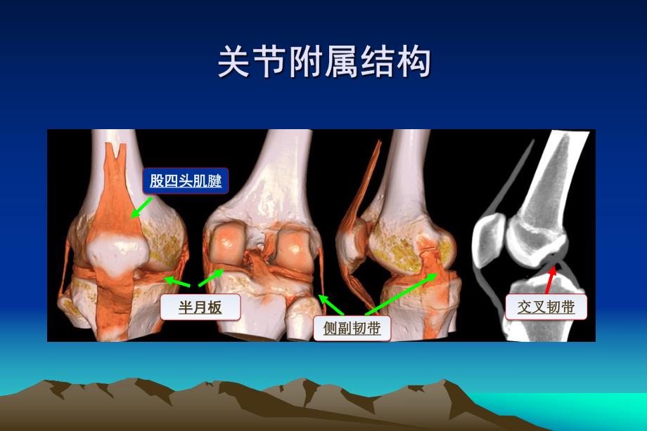 关节置换的康复(髋关节).ppt_第3页