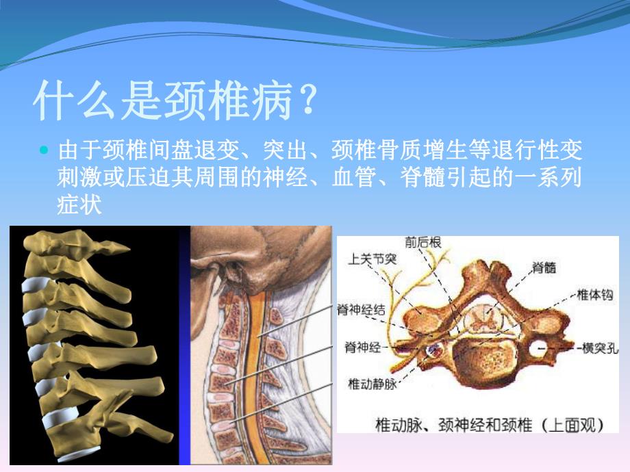 颈椎病的治疗与康复幻灯片.ppt_第2页