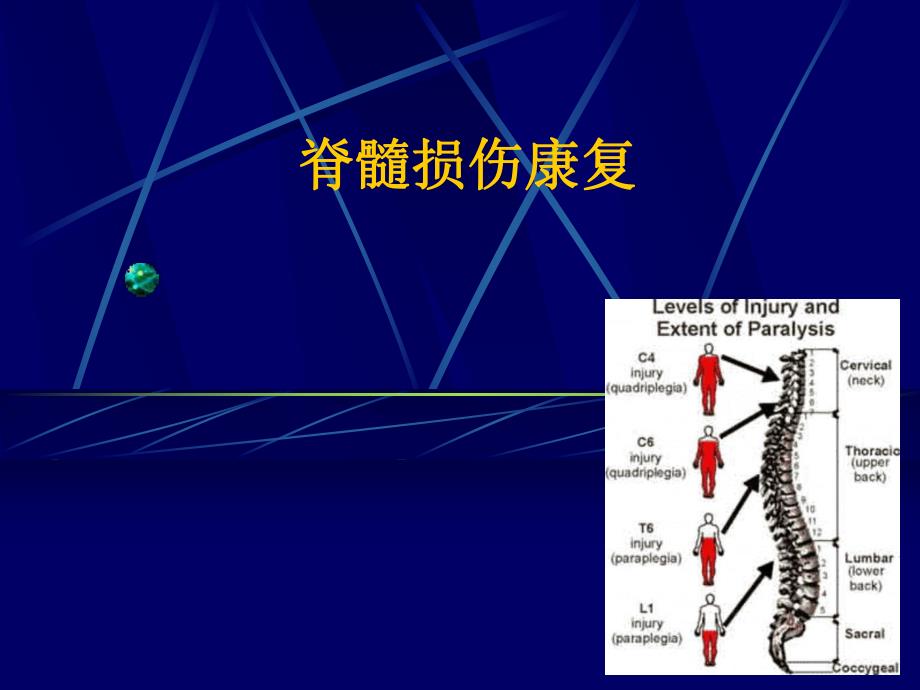 脊髓损伤康复.ppt_第1页