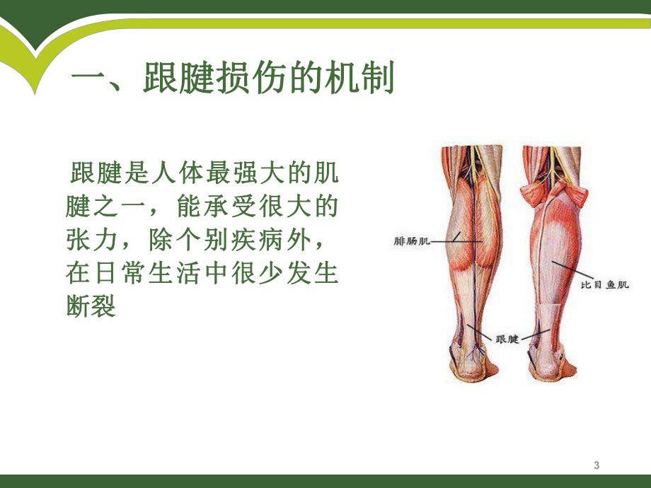 跟腱锻炼术后康复训练.ppt_第3页