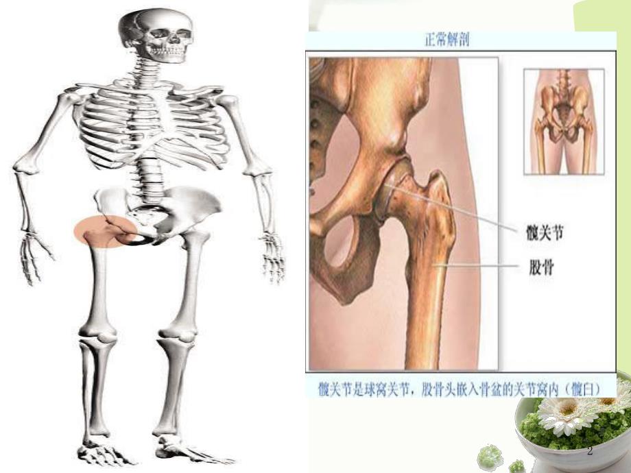 髋关节置换术后康复护理.ppt_第2页