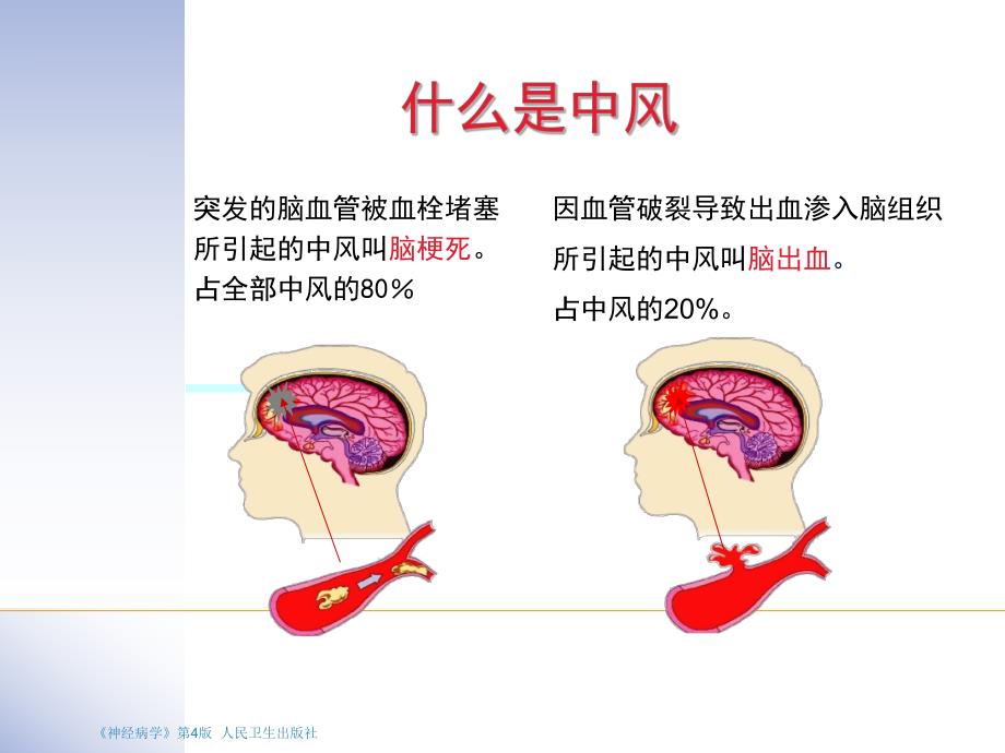 西医对脑中风识别及预防.ppt.ppt_第2页