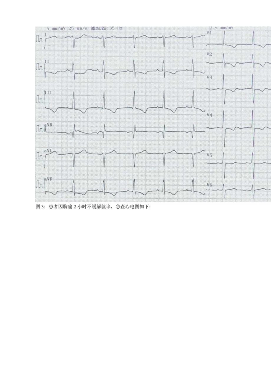 心电图阅图试题14题及答案.docx_第2页