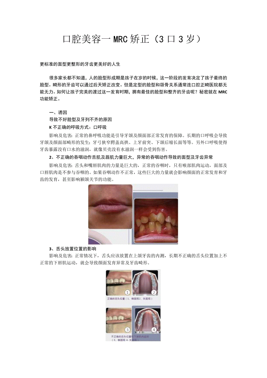 医美口腔美容mrc矫正项目知识话术.docx_第1页