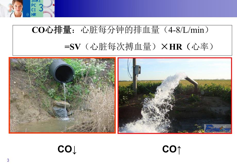 PiCCO参数的临床意义.ppt_第3页