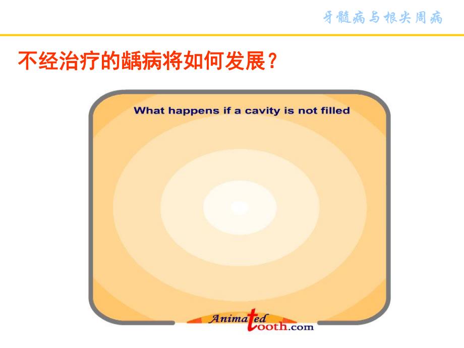 牙髓病与根尖周病.ppt_第3页