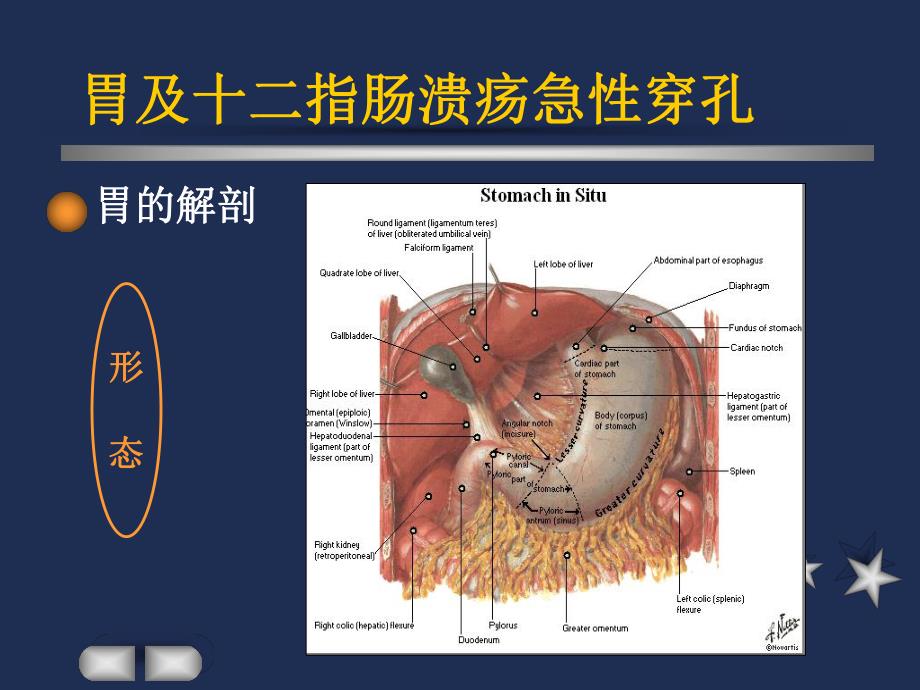 胃及十二指肠溃疡急性穿孔.ppt_第3页