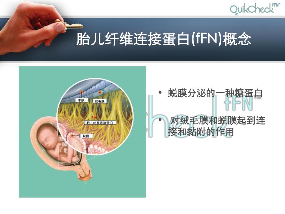 fFN临床应用.ppt_第2页