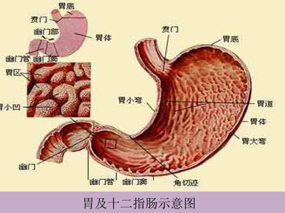 消化性溃疡的护理.ppt_第3页