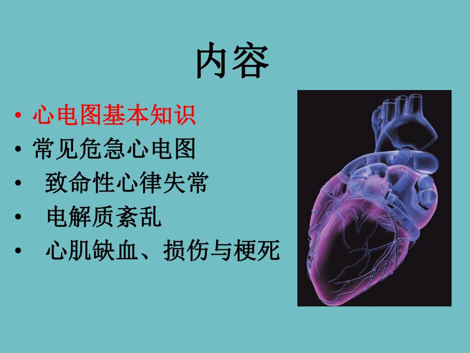 临床常见危急心电图的识别.ppt_第2页