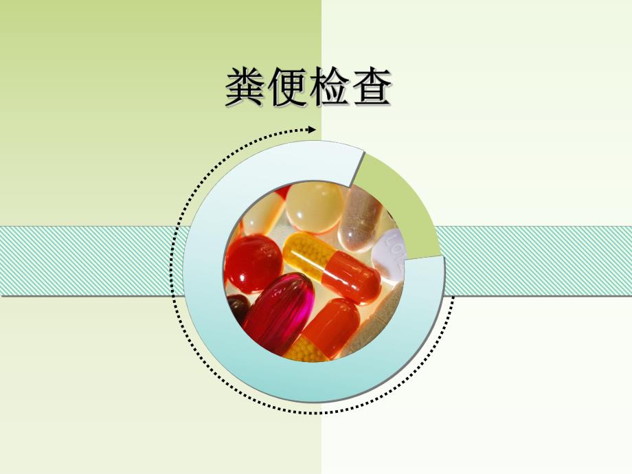 第4章其他排泄物和体腔液检查.ppt_第1页