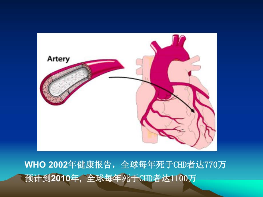 冠心病健康宣教.ppt_第2页