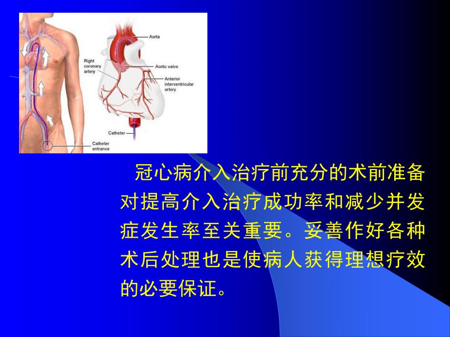 冠心病介入治疗的术前准备和术后处理幻灯片.ppt_第3页