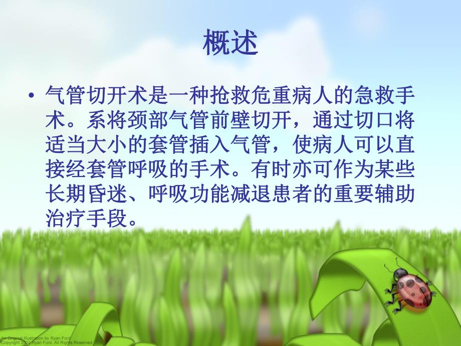 气管切开护理.ppt_第2页