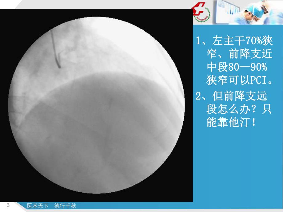 冠心病介入病例和他汀的应用.ppt_第3页