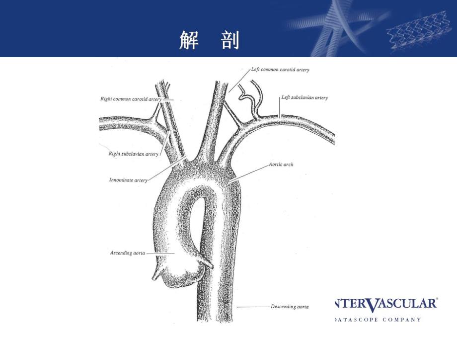 阜外大血管：胸主动脉手术.ppt_第2页