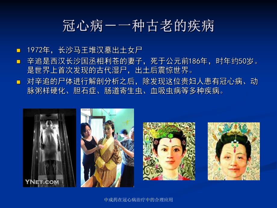 中成药在冠心病治疗中的合理应用.ppt_第2页