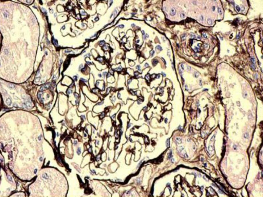 医学资料肾脏病理基础.ppt_第3页