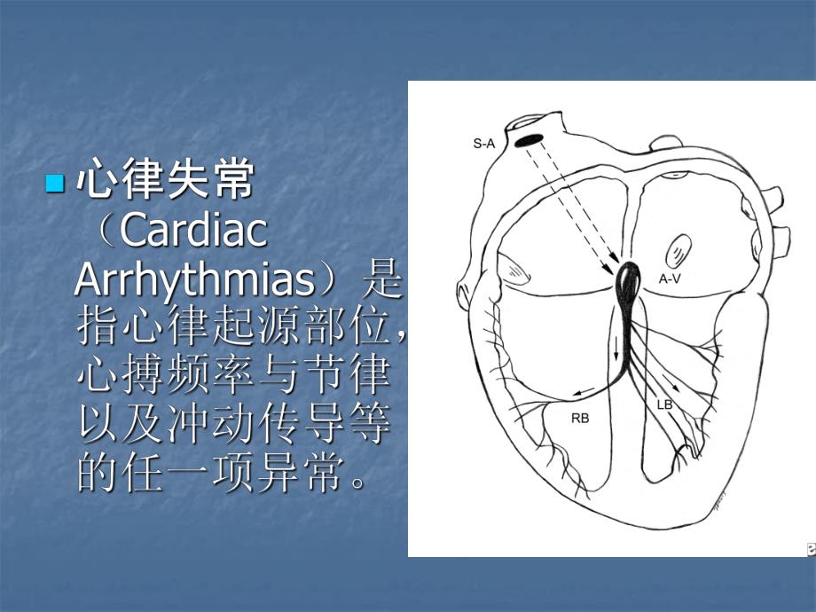 第5节心律失常.ppt_第2页