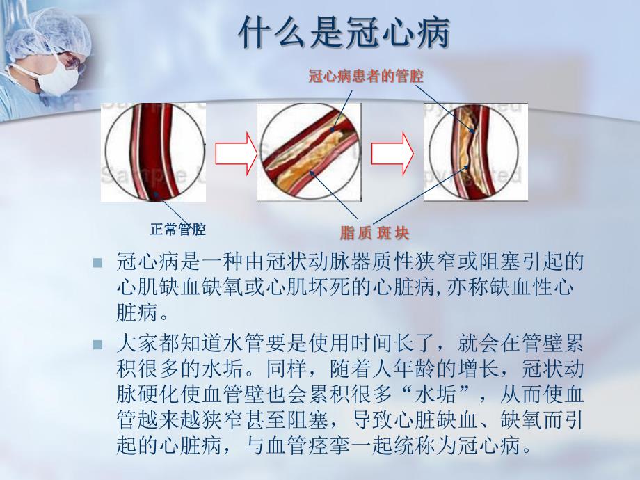 社区健康讲座PPT冠心病心绞痛的防治.ppt_第2页