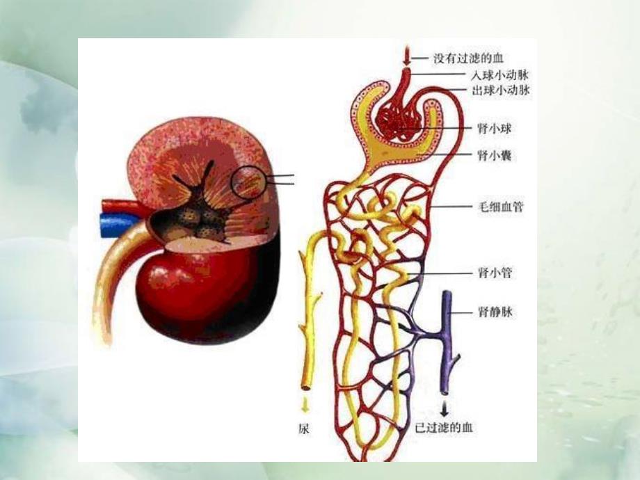 急性肾小球肾炎.ppt_第3页