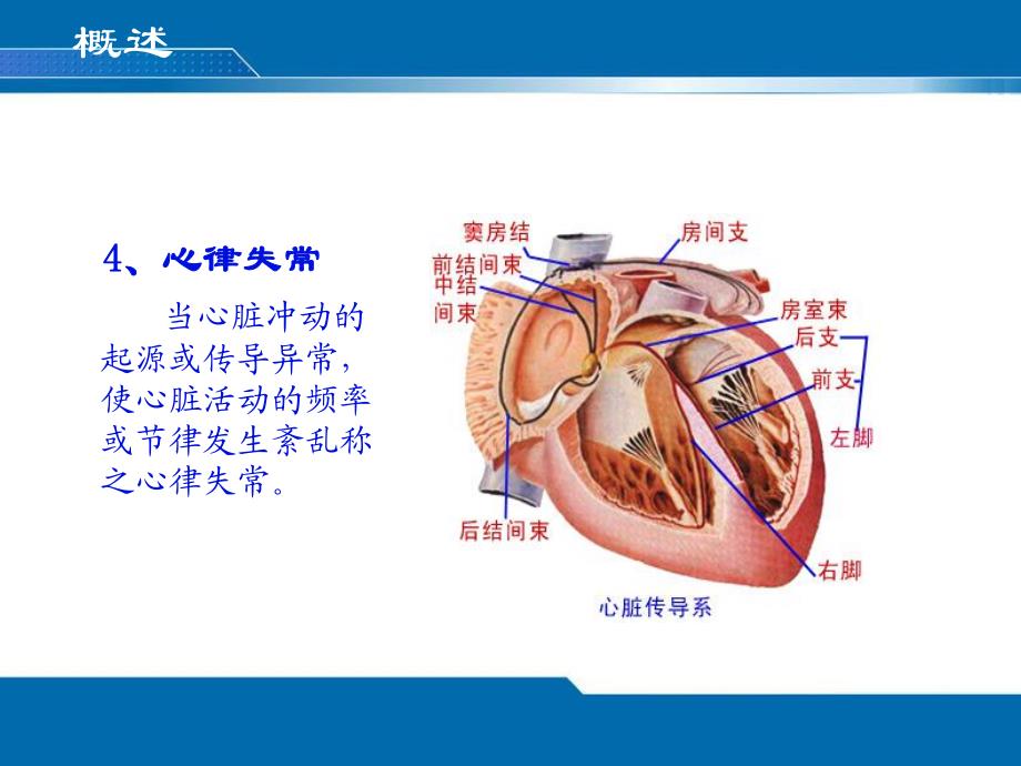 心律失常.ppt_第3页