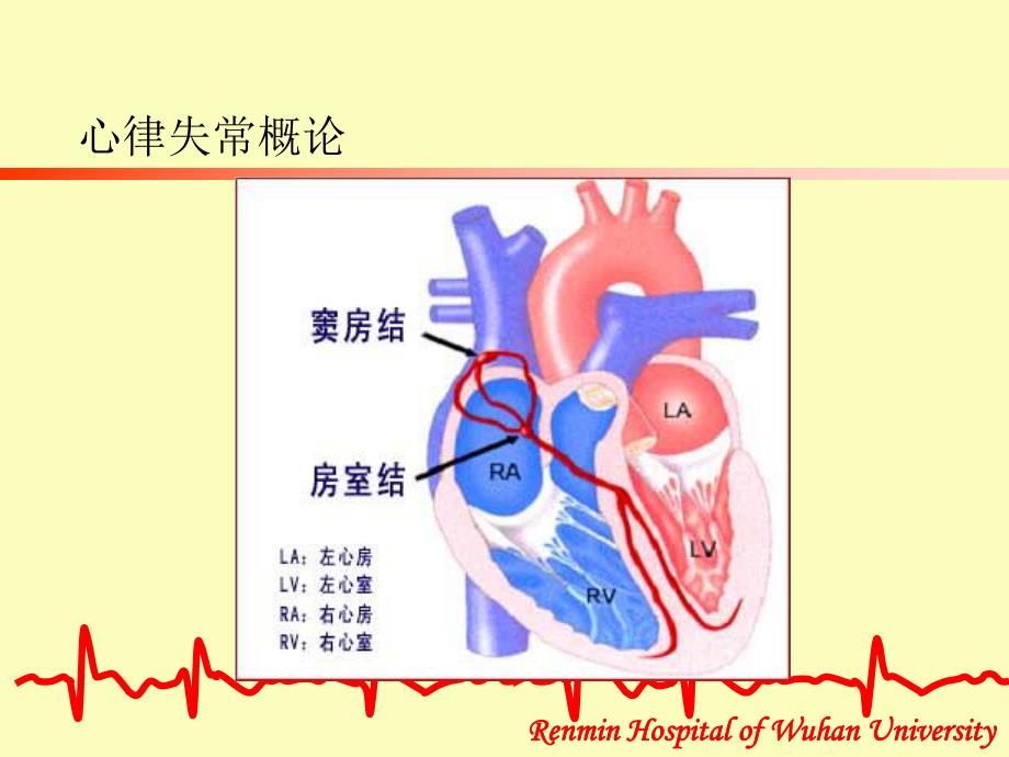 心律失常的防治.ppt_第3页