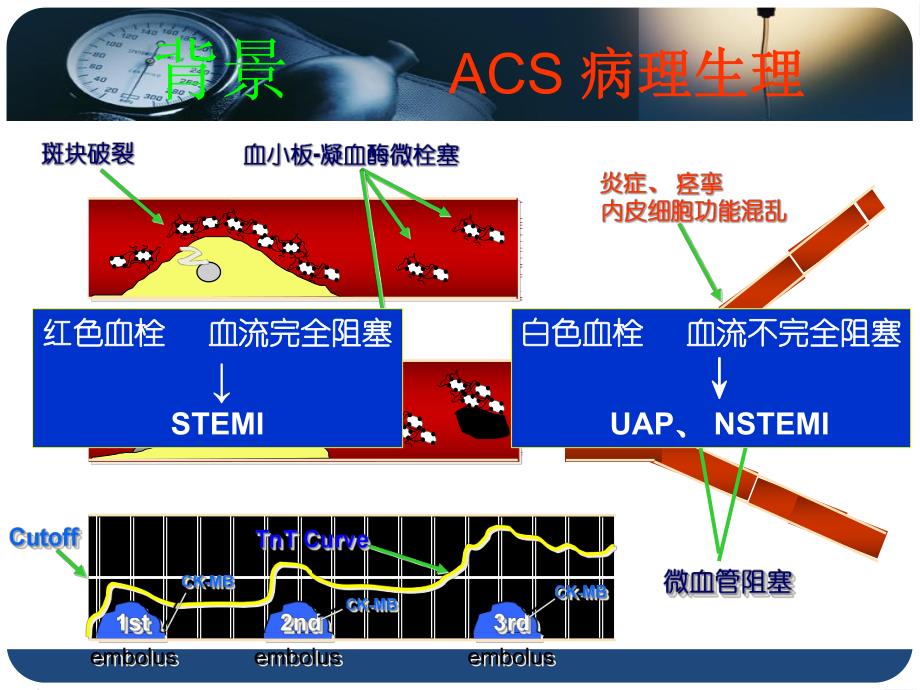 替罗非班在ST段抬高型心肌梗死急诊介入治疗中的应用研究.ppt_第2页