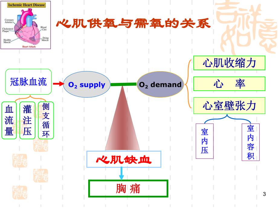 心绞痛小讲课.ppt_第3页