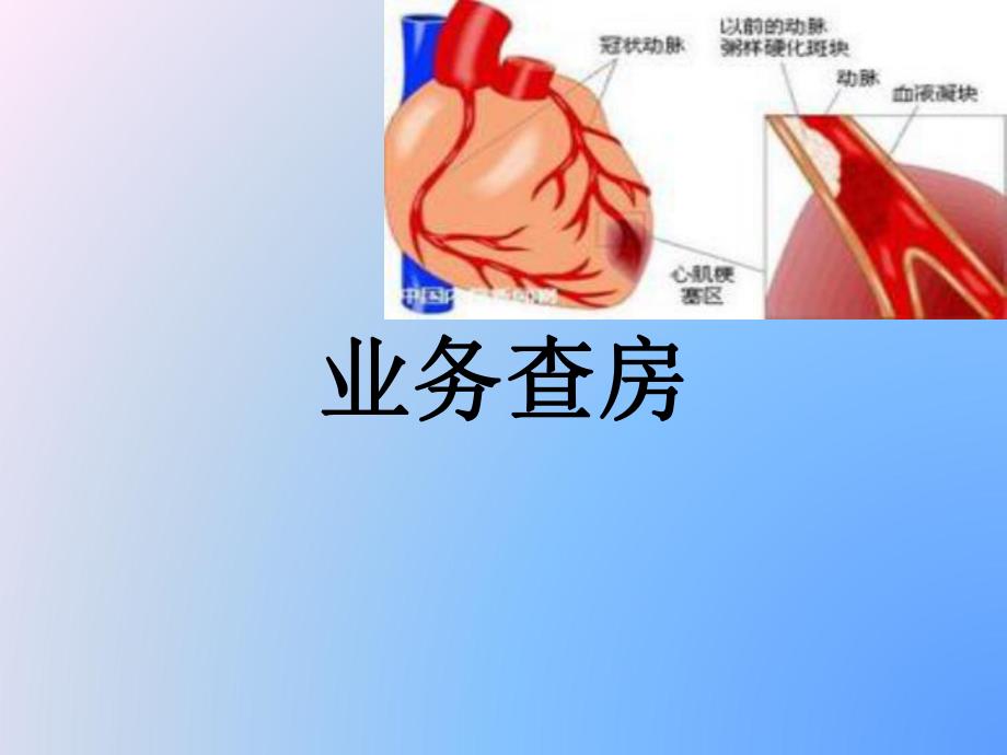 扩张性心肌病.ppt_第1页